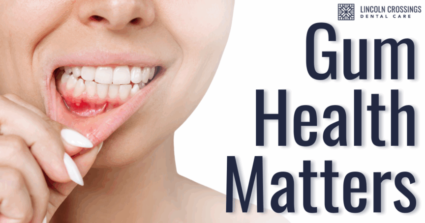 Stryker Email June 2025